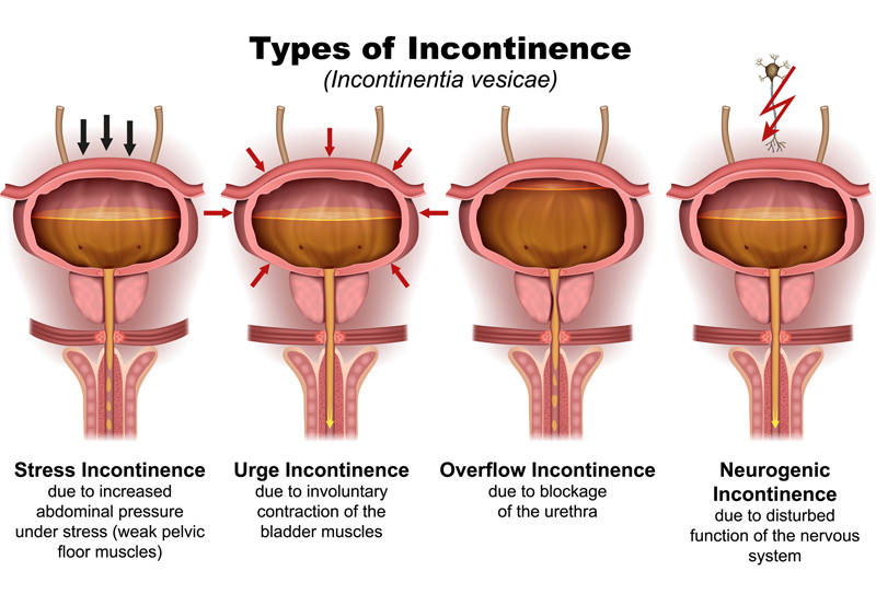 Incontinence Solutions