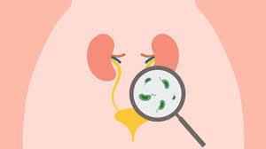 UTI Diagnosis & Treatment
